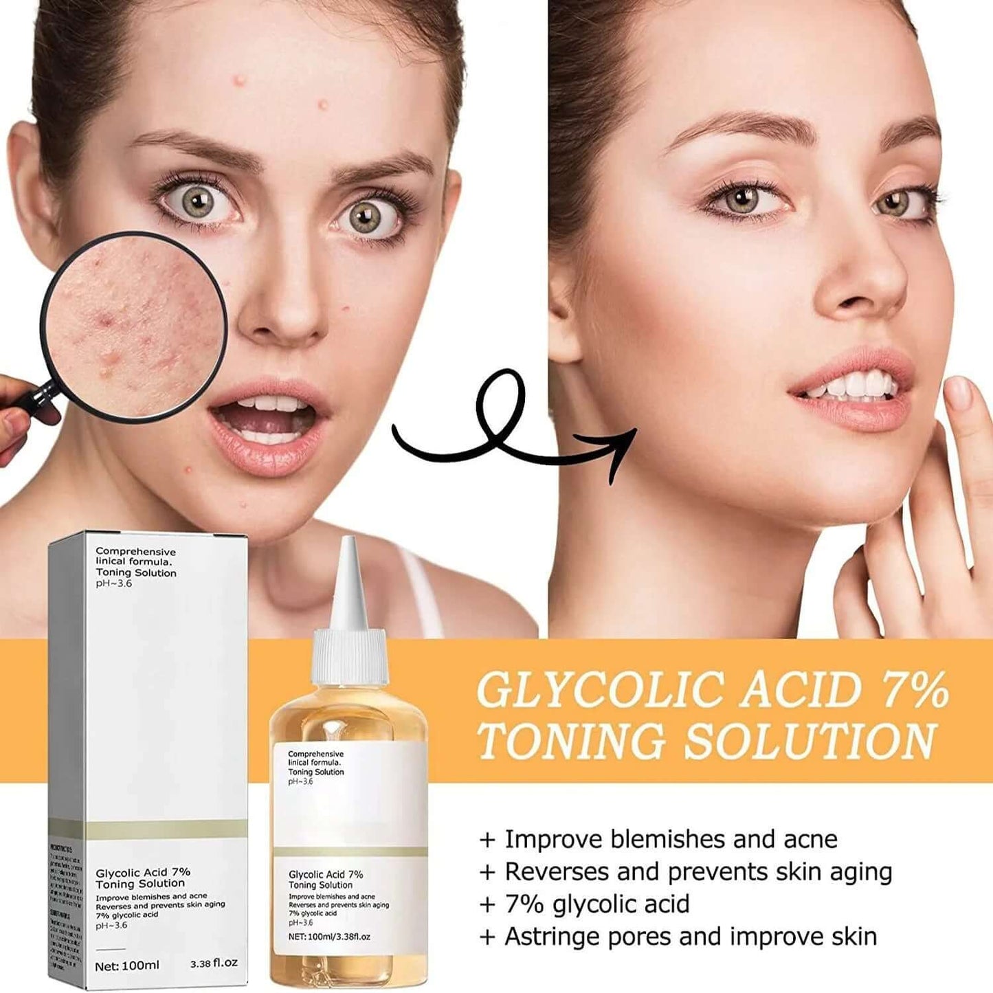 Glycolic Acid Exfoliation