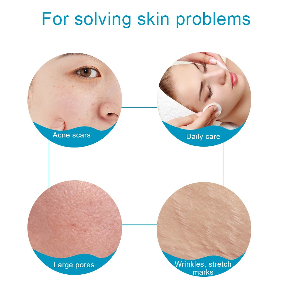 540 Derma Roller Skin Care Micro Needle Dermaroller Professional Derma Roller For Hair Growth Beard Growth Facial Beauty Roller